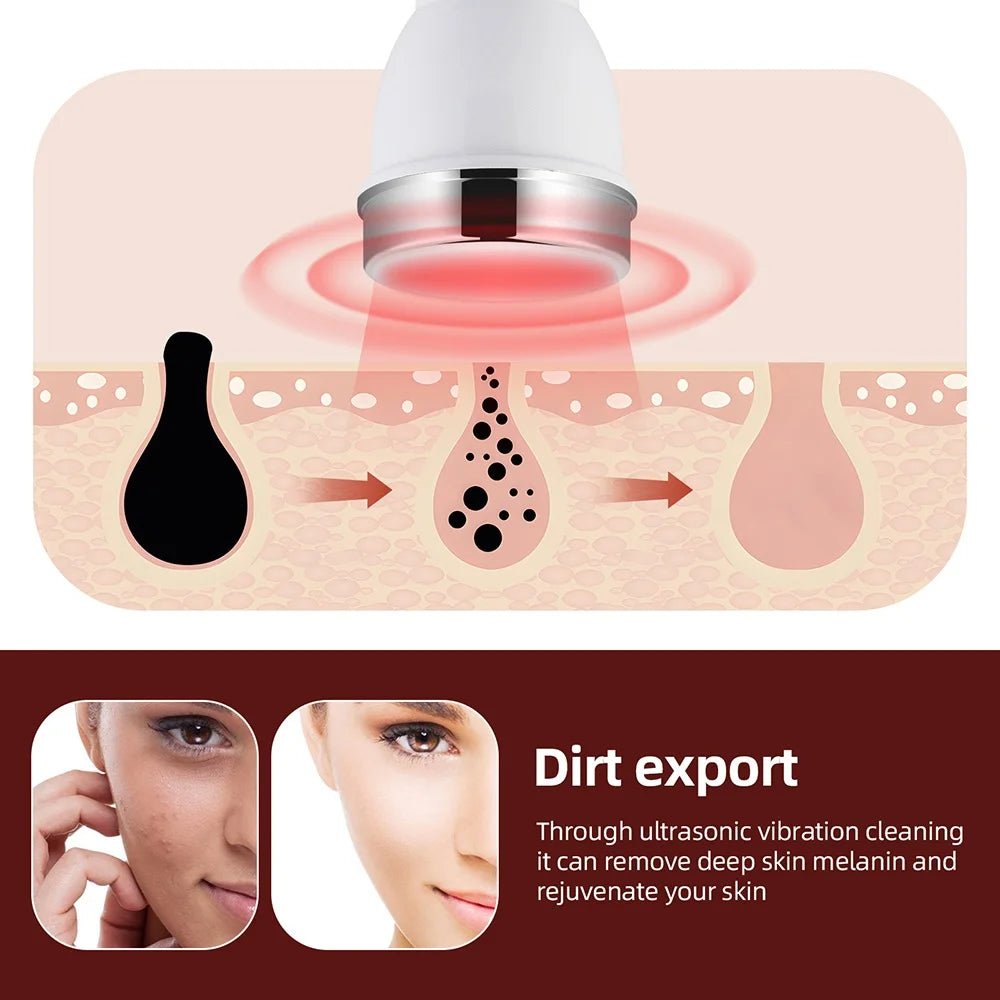 Máquina de cuidado facial ultrasónica – masajeador anti-edad para piel y ojos
