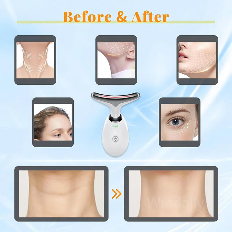 Dispositivo de belleza facial – masajeador para lifting y cuidado del cuello con 7 colores