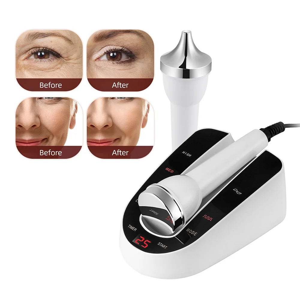 Máquina de cuidado facial ultrasónica – masajeador anti-edad para piel y ojos
